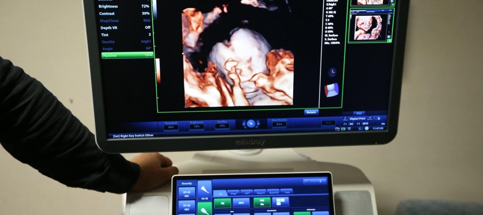 Kars’ta 4 Boyutlu Ultrason Dönemi Başladı! 